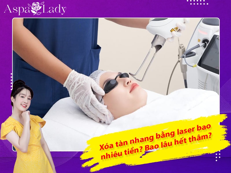Xóa tàn nhang bằng laser bao nhiêu tiền? Bao lâu hết thâm?